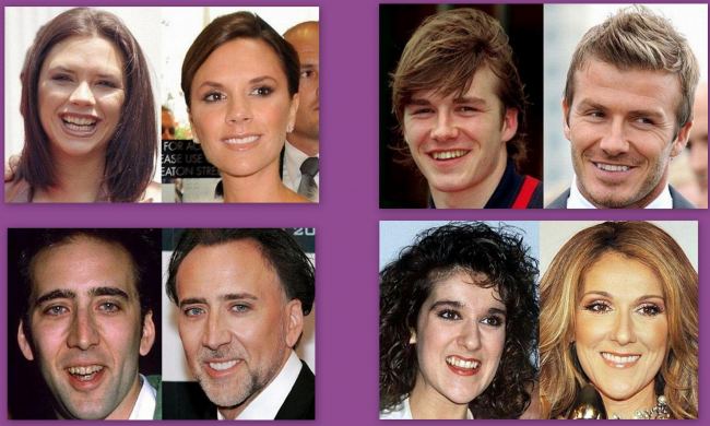 Το μυστικό του λαμπερού χαμόγελου των stars