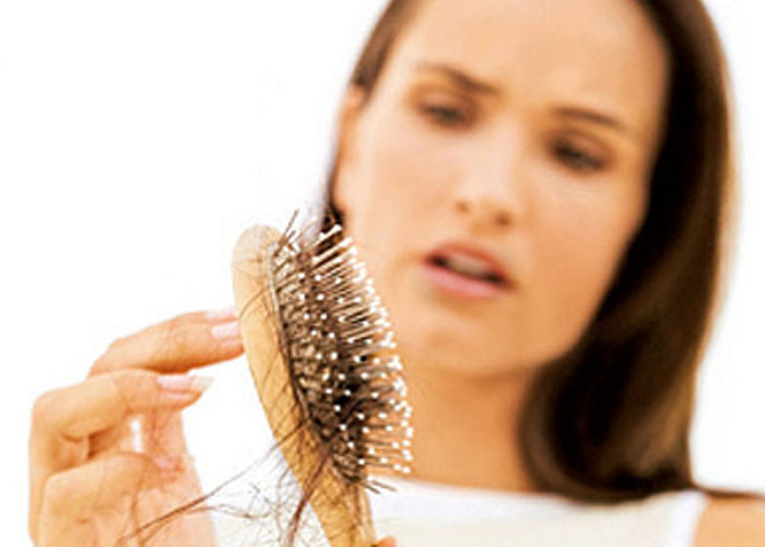 hair-loss
