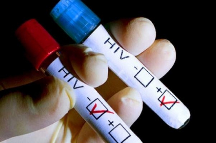 Ασυνήθιστη αύξηση του AIDS στην Αλβανία