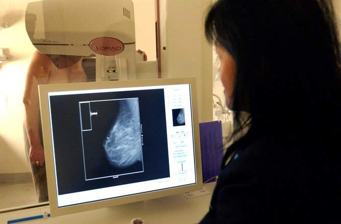 Καρκίνος στήθους: Πιο κοντά στο φάρμακο που θα βάζει φρένο στις μεταστάσεις