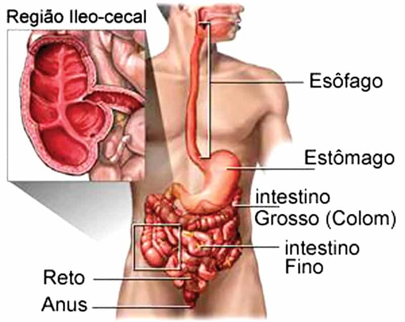 Τα προβλήματα των ασθενών με νόσο Crohn & ελκώδη κολίτιδα