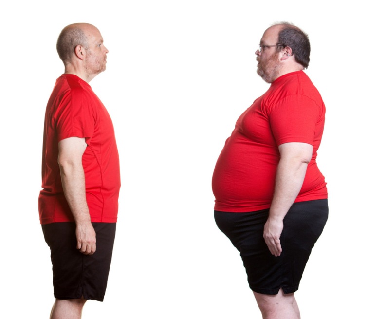 Παχυσαρκία: ευθύνονται τα γονίδια & το περιβάλλον