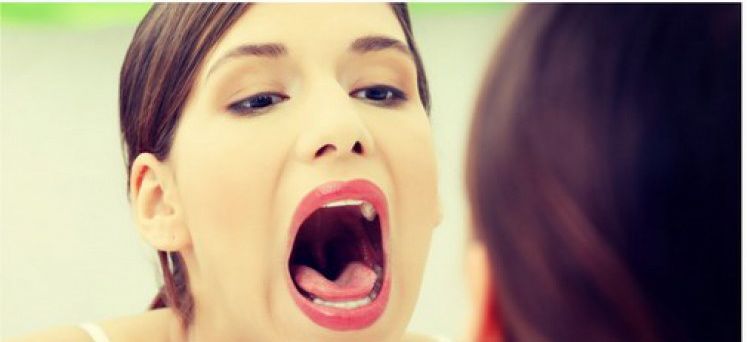 Κορωνοϊός: Μολύνει και τα κύτταρα του στόματος