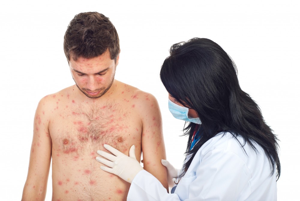 Πέντε βήματα που οδηγούν σε επιδημία ιλαρά