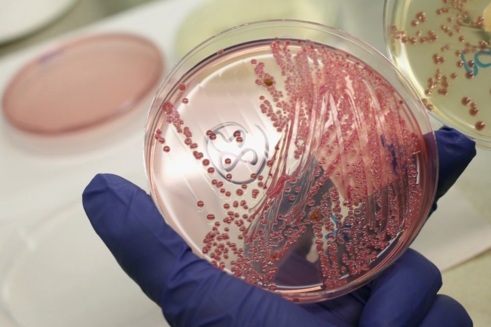 E-Coli:το κλειδί για καταπολέμηση της αντοχής των αντιβιοτικών