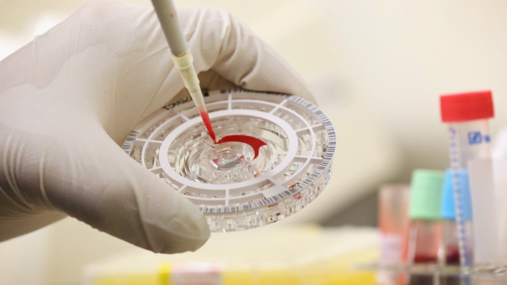 Πειραματικό φάρμακο για τον Έμπολα προωθεί το HHS