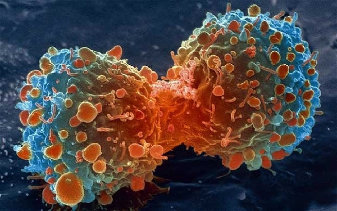 1 στους 5 ασθενείς ζουν την επανεμφάνιση καρκίνου
