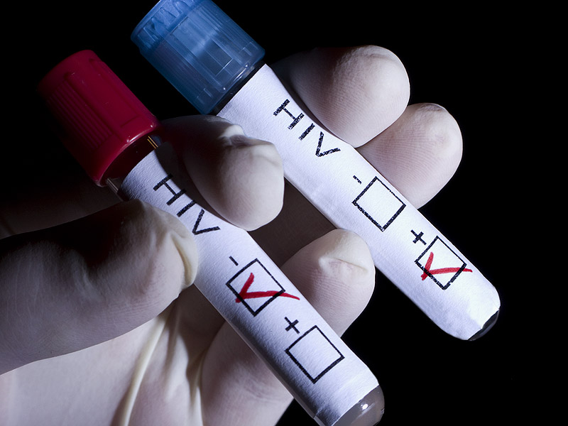 Δωρεάν εξετάσεις για AIDS και ηπατίτιδα