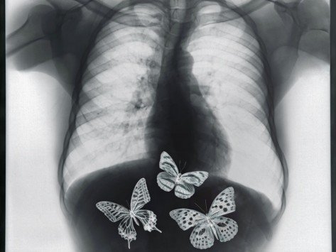 Πώς εξηγούνται επιστημονικά οι «πεταλούδες στο στομάχι»;