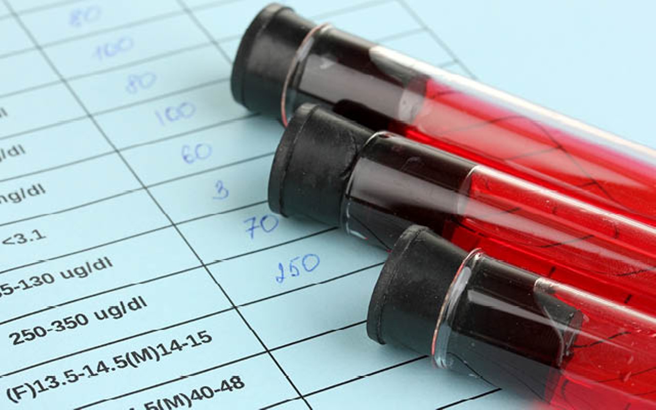 Φοβούνται να κάνουν τεστ για τον ιό HIV