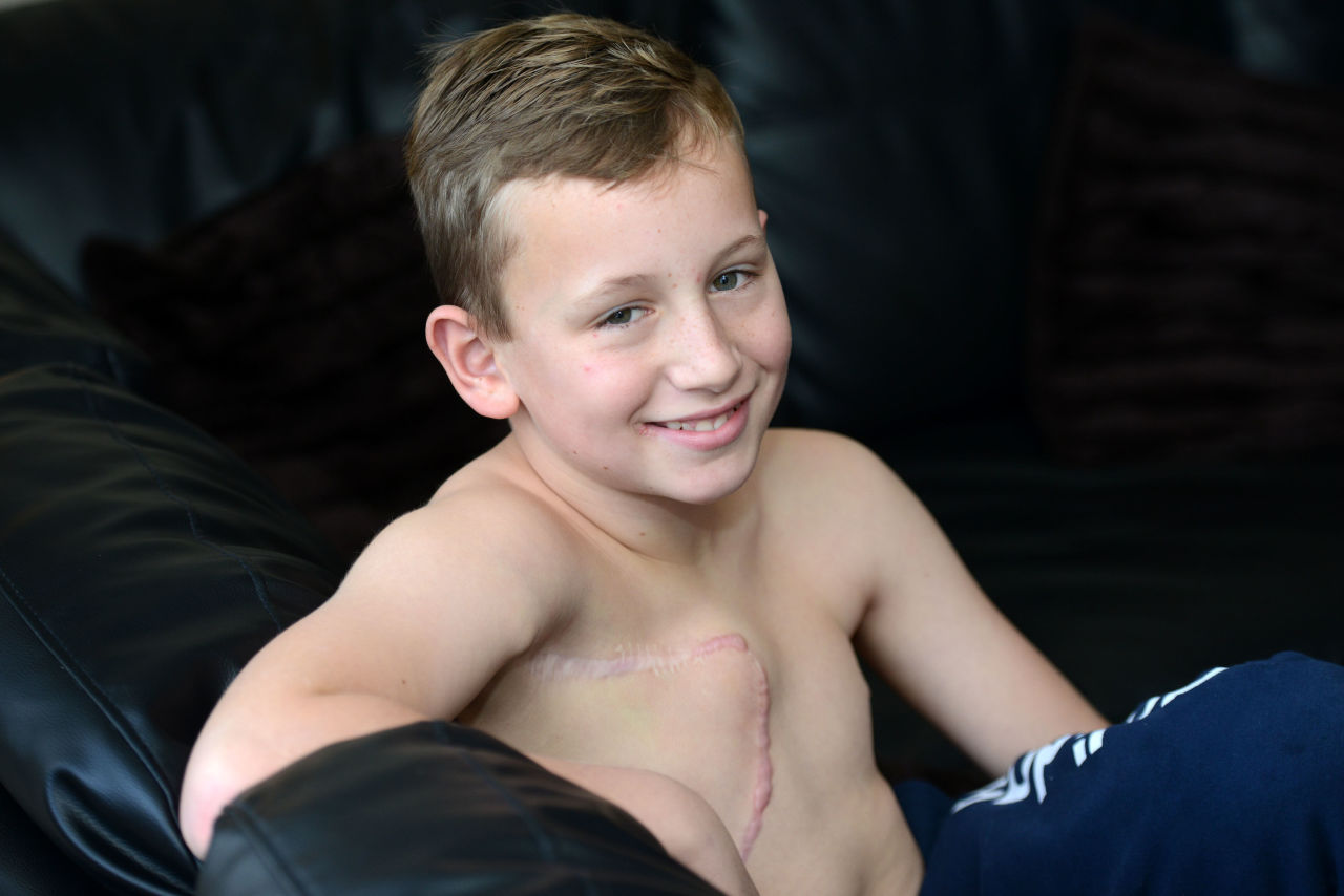 Μαστεκτομή σε 11χρονο αγόρι από το Μάντσεστερ