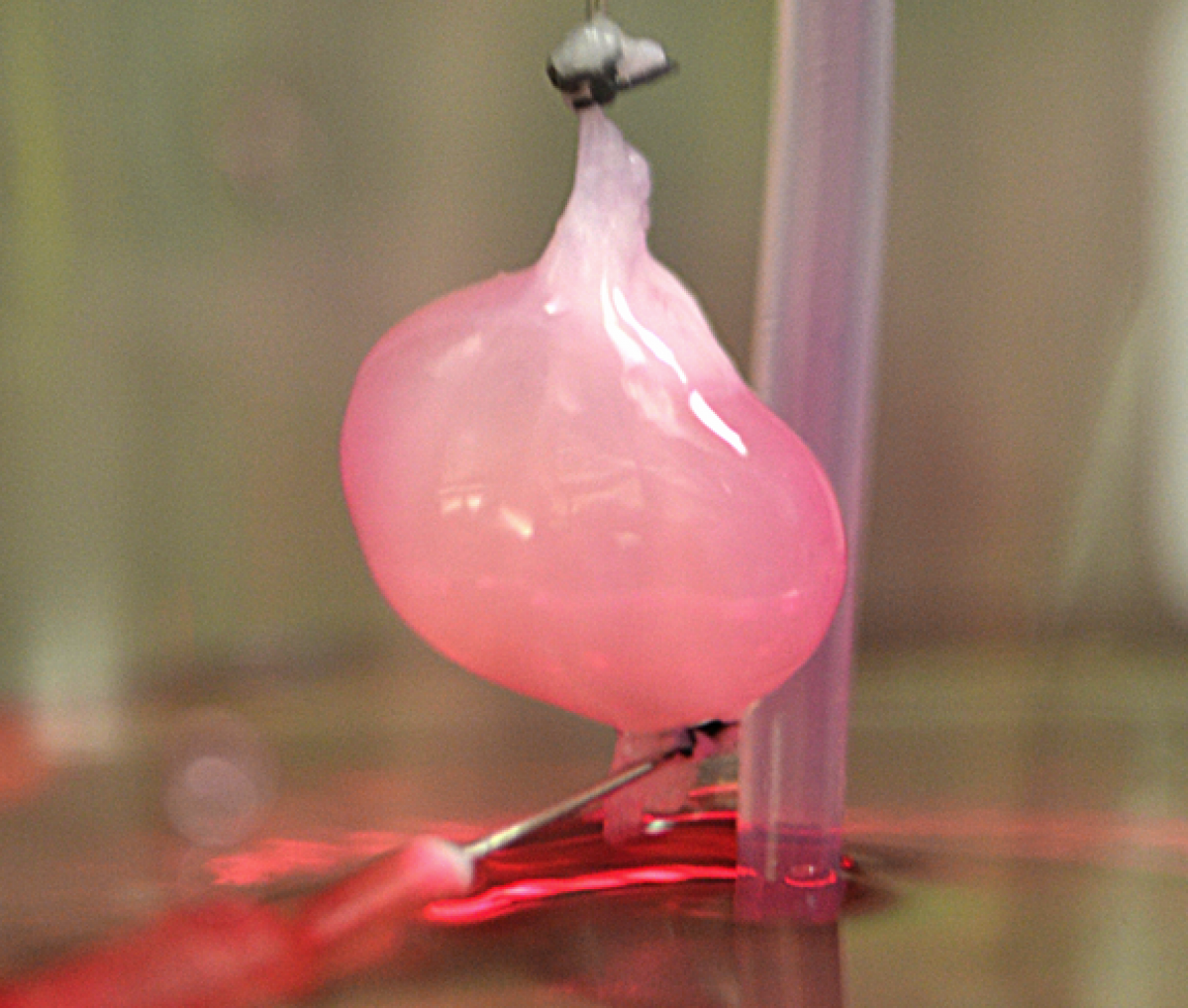 Τεχνολογία 3D εκτύπωσης σε μεταμόσχευση νεφρού