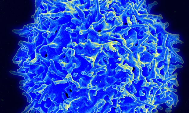 Τροποποιημένα Τ-λεμφοκύτταρα καταστρέφουν όγκους