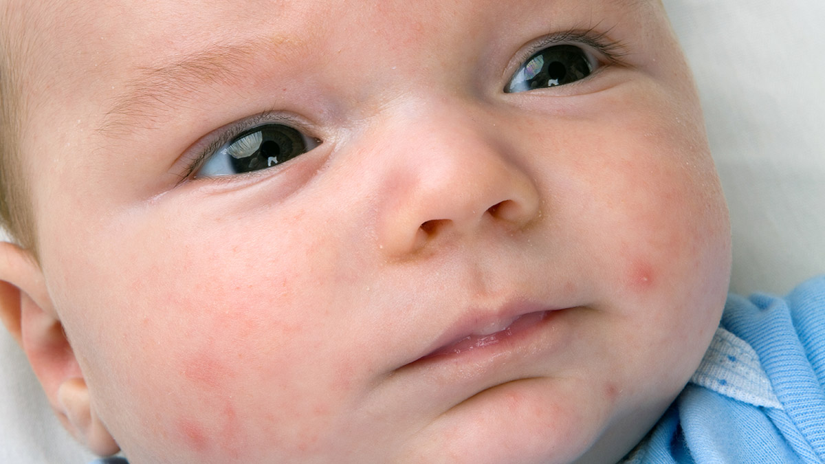 Η εποχή γέννησης και ο κίνδυνος αλλεργιών