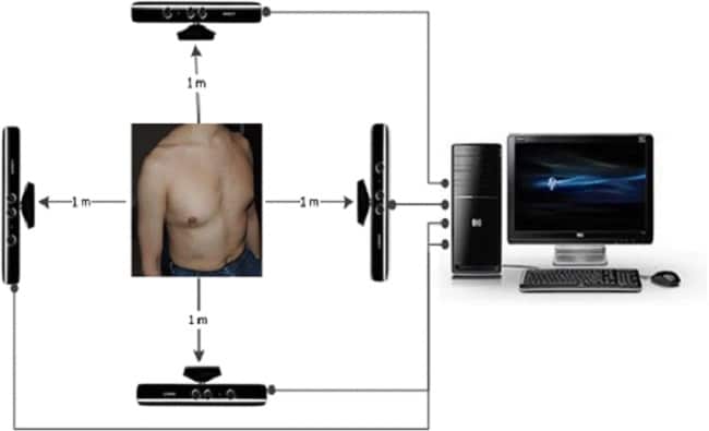 Το Xbox βοηθά στη διάγνωση της κυστικής ίνωσης