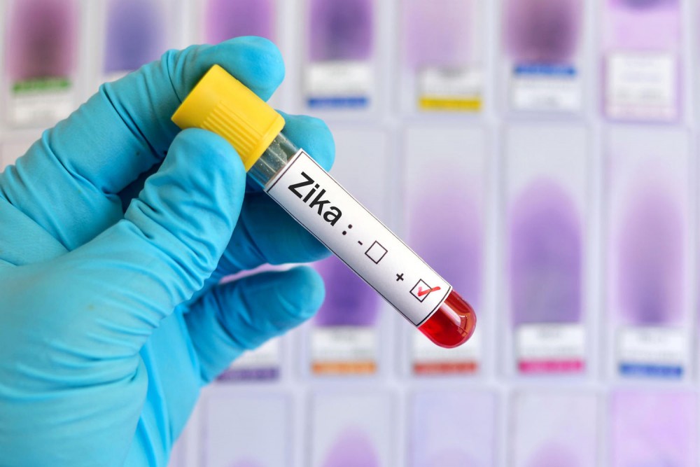 Νέες οδηγίες για προστασία από τον ιό Ζίκα