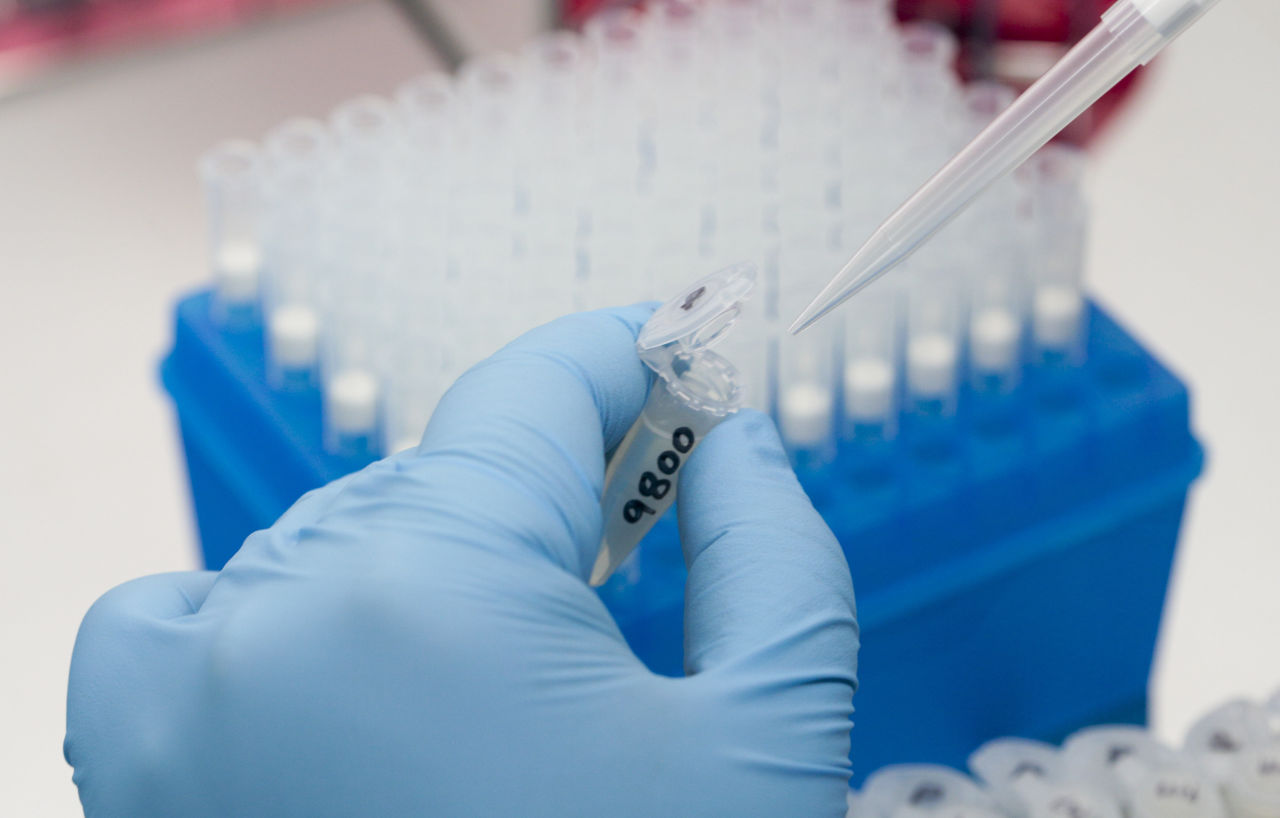 Πειραματικό τεστ για τον έλεγχο του ιού Ζίκα στις αιμοδοσίες
