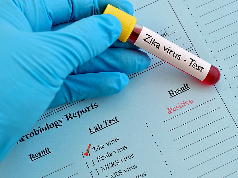 Ο ιός Ζίκα «ζει» περισσότερο στα ούρα από ό, τι στο αίμα