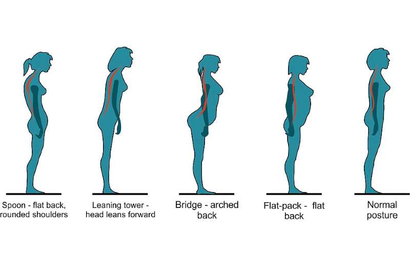 H στάση του σώματος και οι πόνοι στην πλάτη
