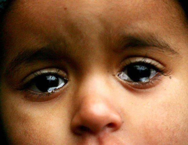 Ένας στους έξι παιδικούς τραυτισμούς λόγω πολέμου στο Ιράκ
