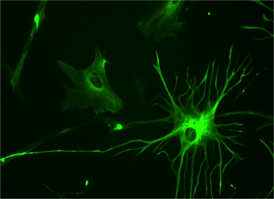 Νέα ανακάλυψη:τα αστροκύτταρα βοηθούν στην αποκατάσταση εγκεφαλικού