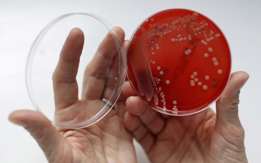 Νέο αντιβιοτικό αντιμετωπίζει τα υπερ-ανθεκτικά μικρόβια