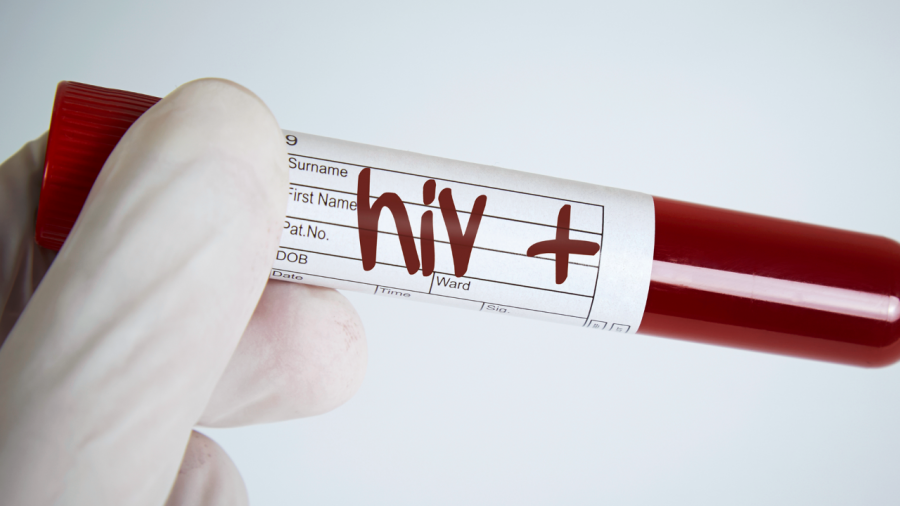HIV: Νέα μέθοδος εντοπίζει τον αδρανή ιό που κρύβεται σε σπάνια κύτταρα