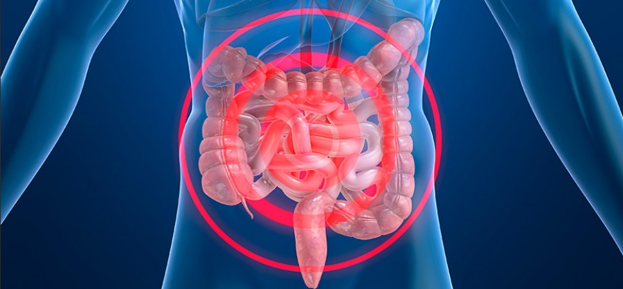 «Παράγοντες κλειδιά» στη νόσο Crohn τα μικρόβια;