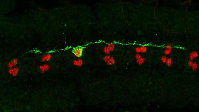 Οι νευρώνες της μύγας «κλειδί»  στην κατανόηση των ψυχικών νοσημάτων
