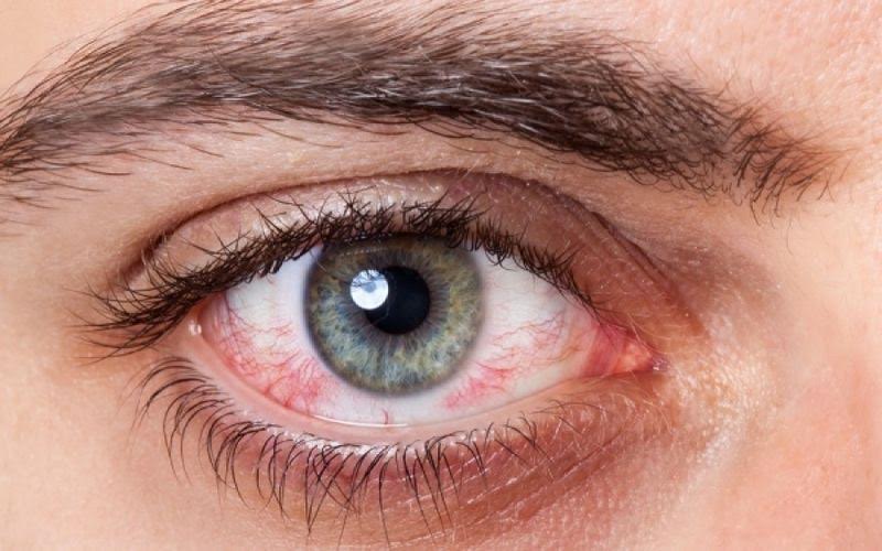 Πρόβλημα στα μάτια; Καταναλώστε ω-3 λιπαρά οξέα