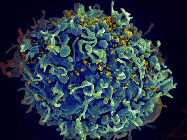 Νέα ισχυρά όπλα κατά του ιού HIV