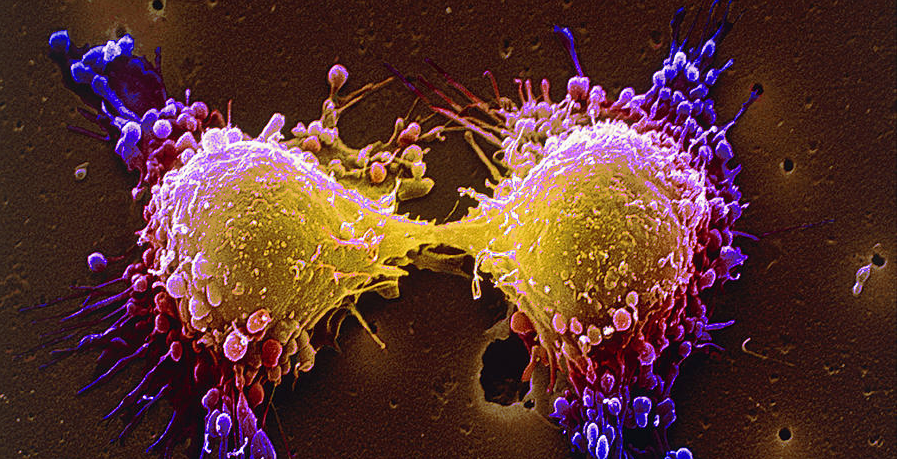 Πως ο καρκίνος μπορεί να υποταχθεί στα χημειοθεραπευτικά