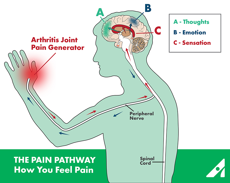 Ο πόνος δεν είναι μόνο θέμα των νεύρων