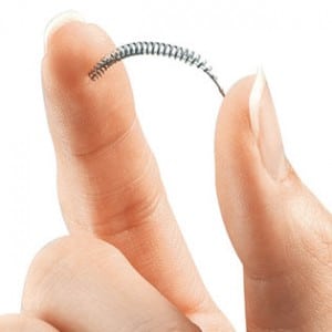 22essure2-master315