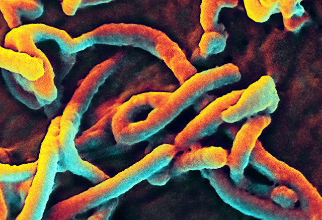 Ο ιός Έμπολα απενεργοποιεί το ανοσοποιητικό σύστημα