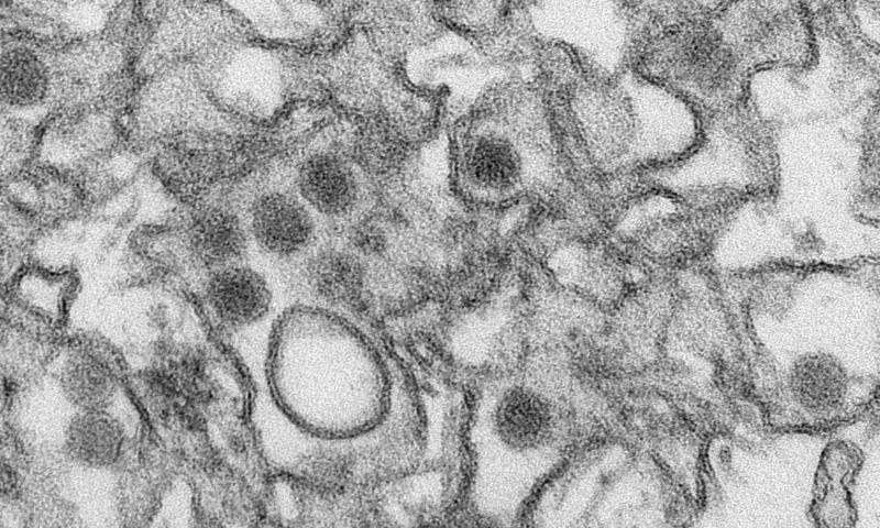 Ο ιός Ζήκα ενοχοποιείται για σοβαρές ανωμαλίες
