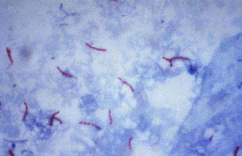 Ερευνητές επιταχύνουν την ανοσιακή απάντηση στη φυματίωση