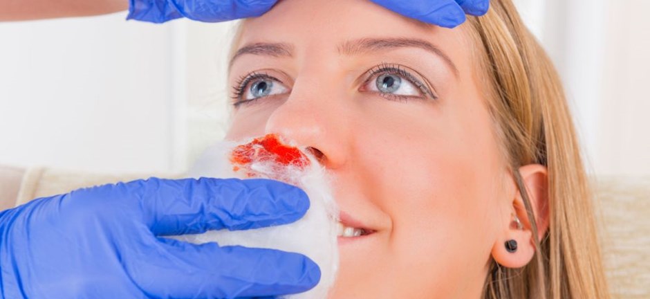 Ρινορραγία: Γιατί τρέχει αίμα από τη μύτη μου;