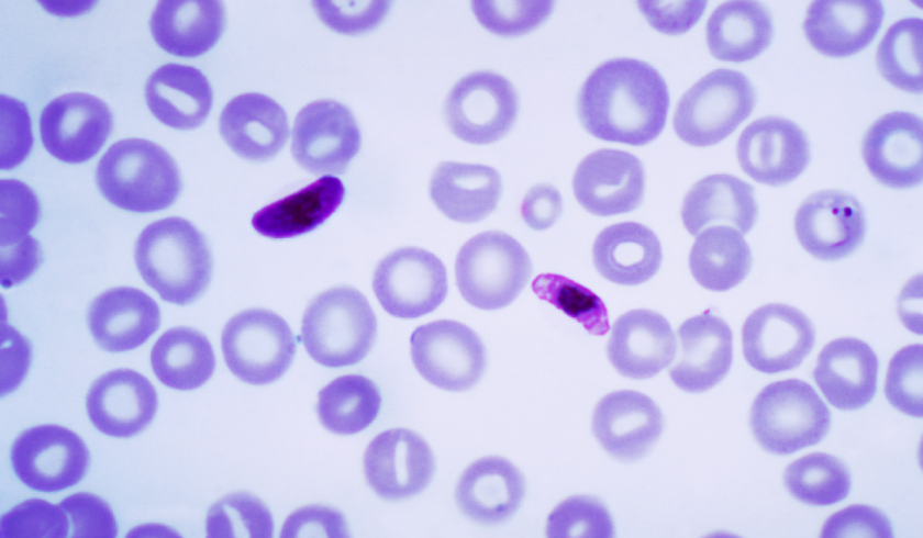 Ταυτοποιήθηκαν τρεις νέες πρωτεΐνες του παράσιτου της ελονοσίας