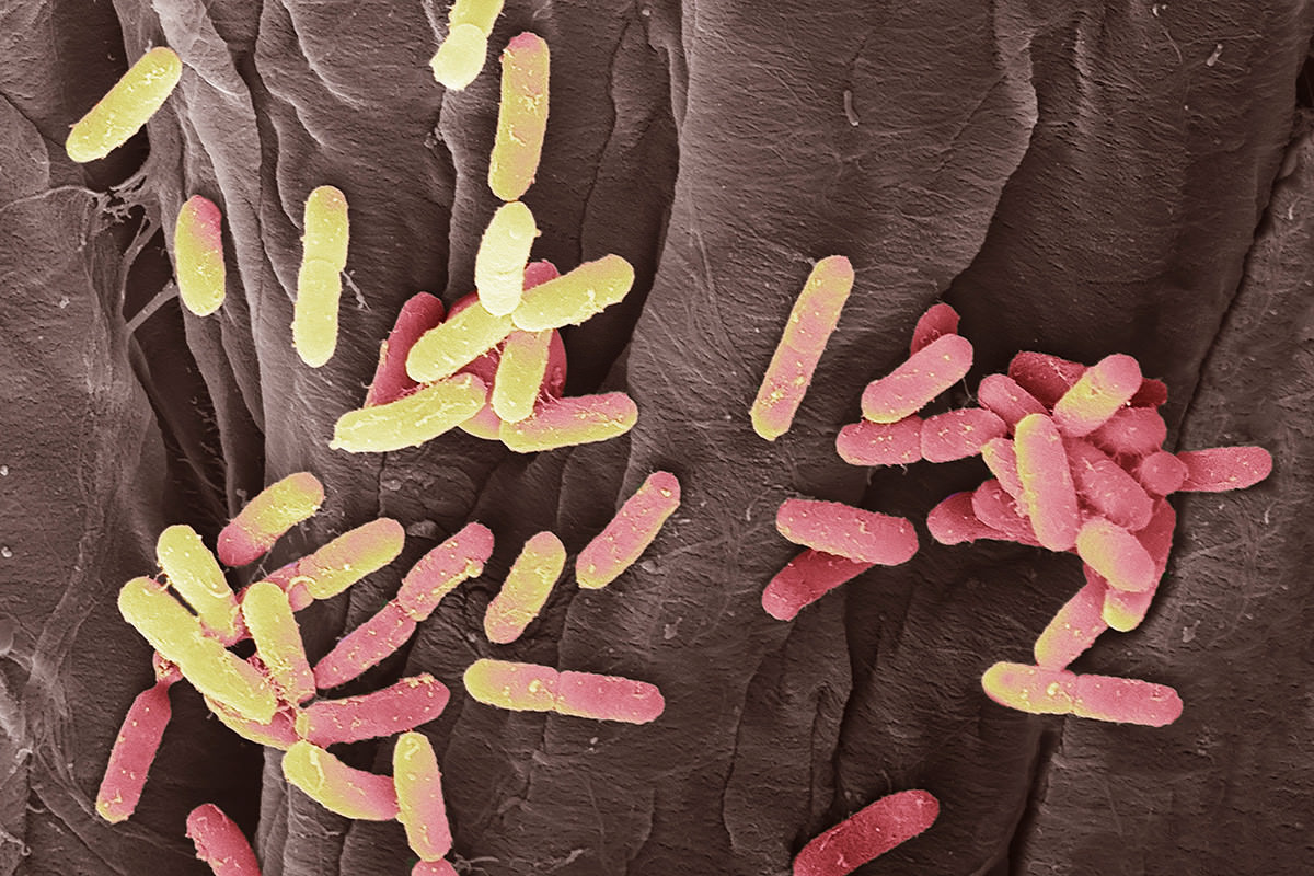 Κολπικά βακτήρια σχετίζονται με υποτροπιάζουσες ουρολοιμώξεις