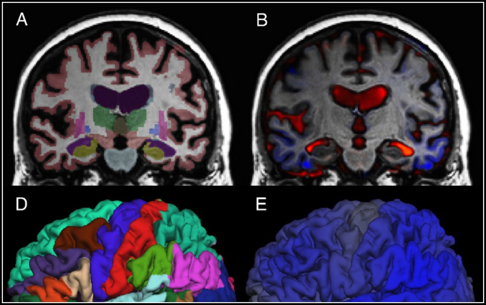 Επιστήμονες χαρτογράφησαν τον «δεύτερο εγκέφαλο»