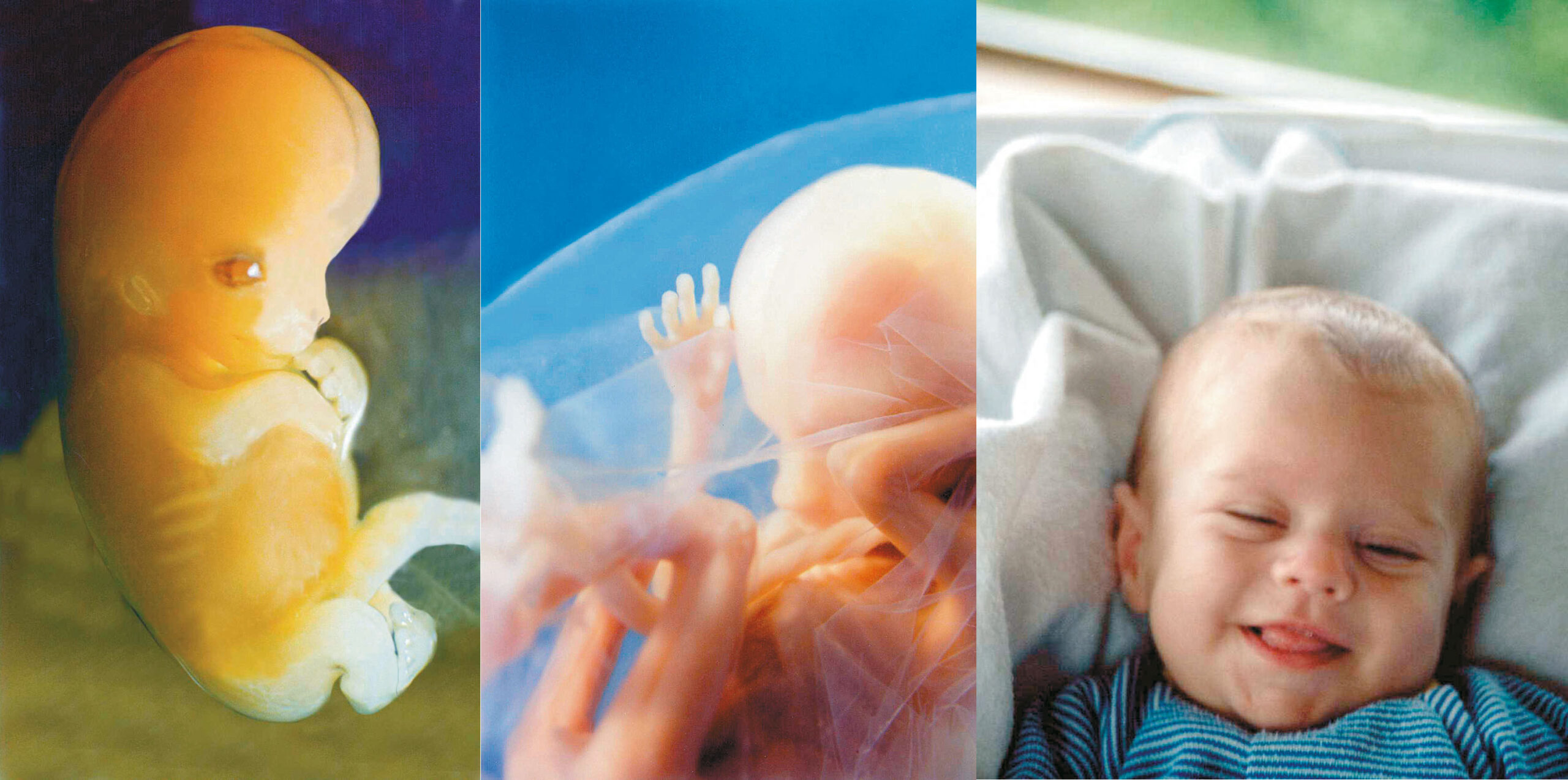 Πρωτοποριακή μελέτη: Τα έμβρυα αναγνωρίζουν πρόσωπα ανθρώπων