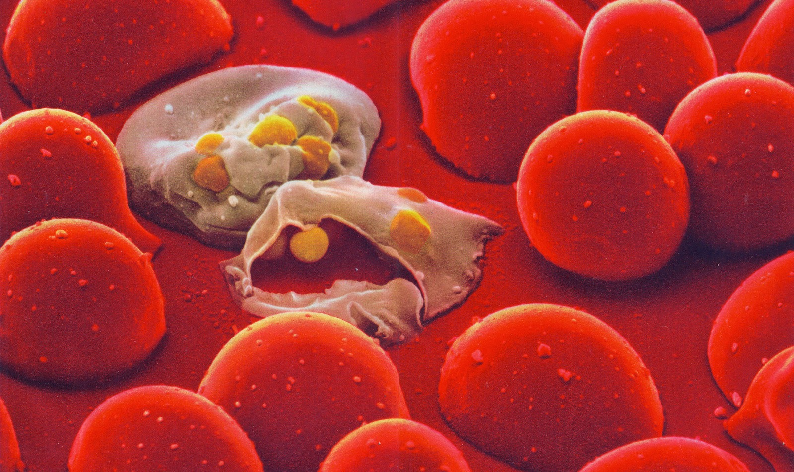 Ανακαλύφθηκε τρόπος πιθανής επιβίωσης από την ελονοσία
