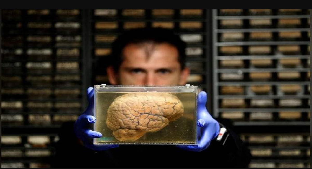 Μεγάλη συλλογή ανθρώπινων εγκεφάλων στο Βέλγιο