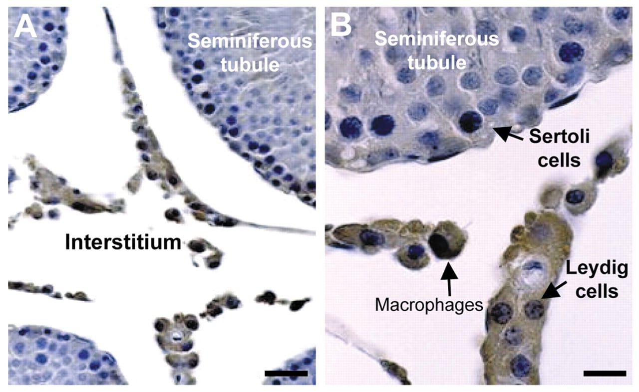 Τα μακροφάγα των όρχεων προστατεύουν τη γονιμότητα