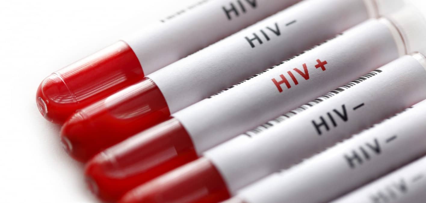 Κακή πρόγνωση ατόμων με HIV που καπνίζουν