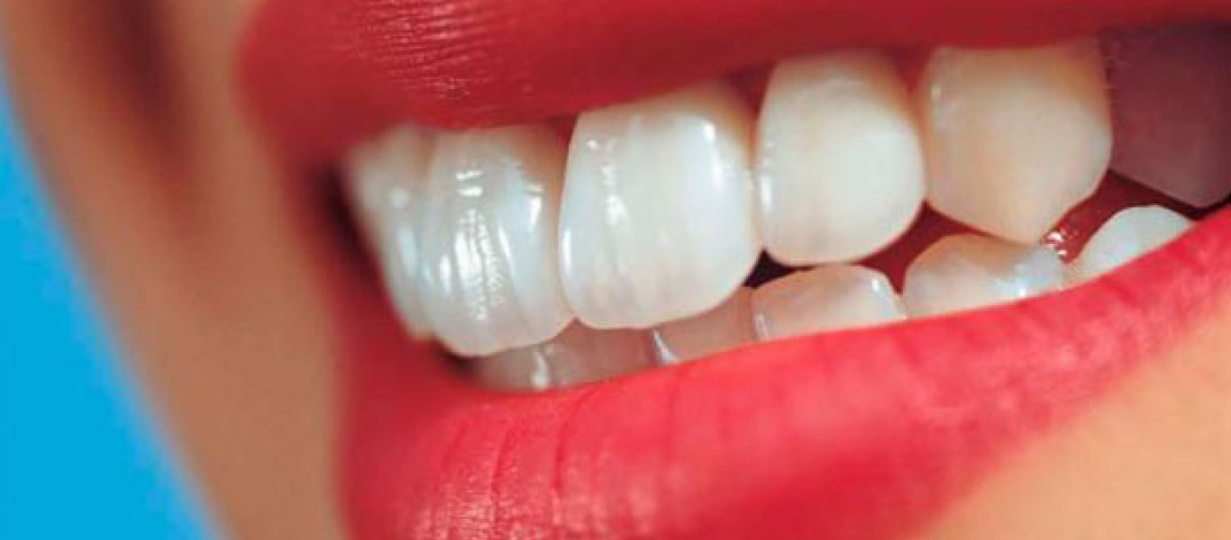 Έξυπνα μυστικά για λεύκανση δοντιών