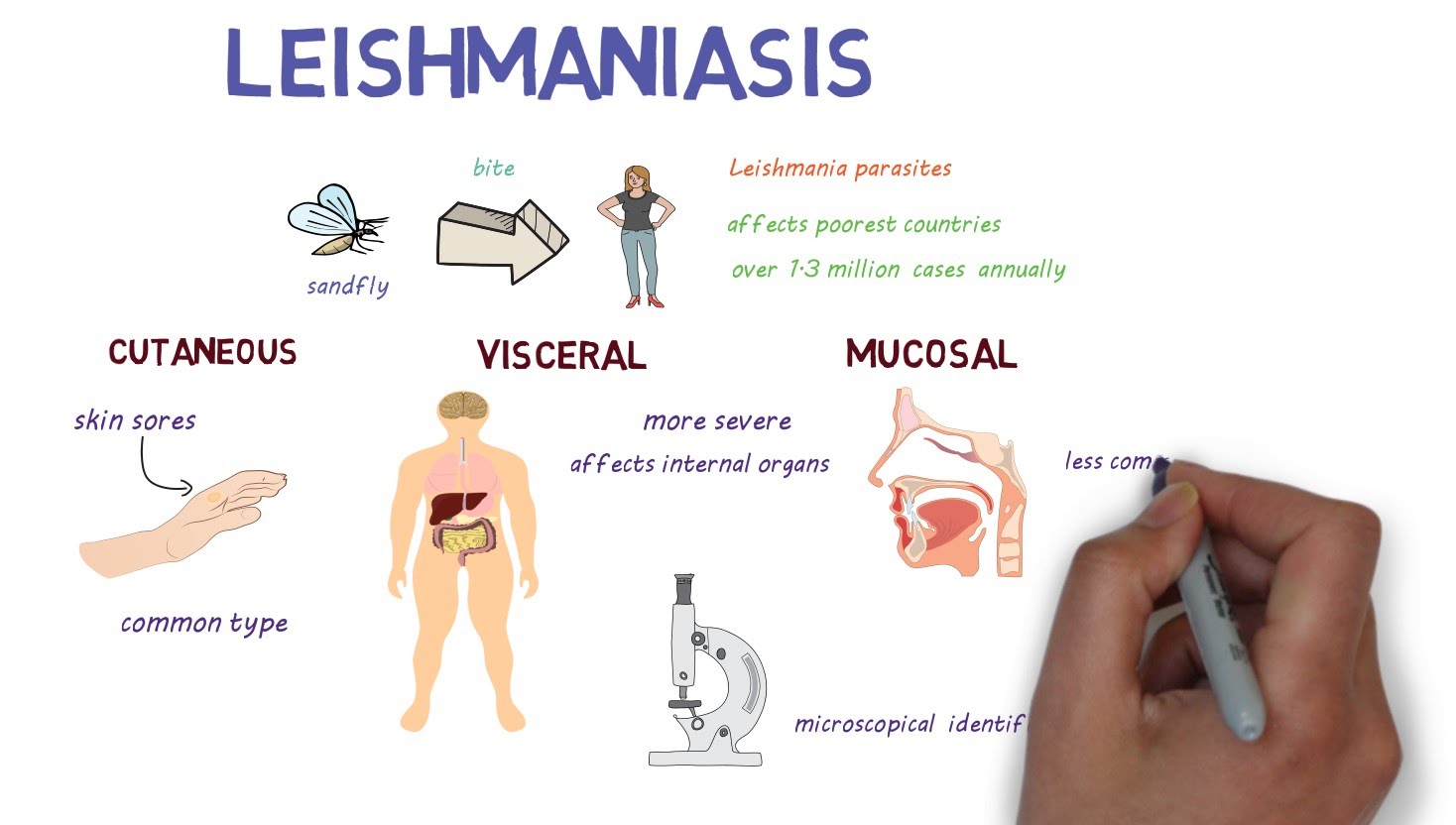 Πώς η Leishmania προκαλεί χρόνια λοίμωξη