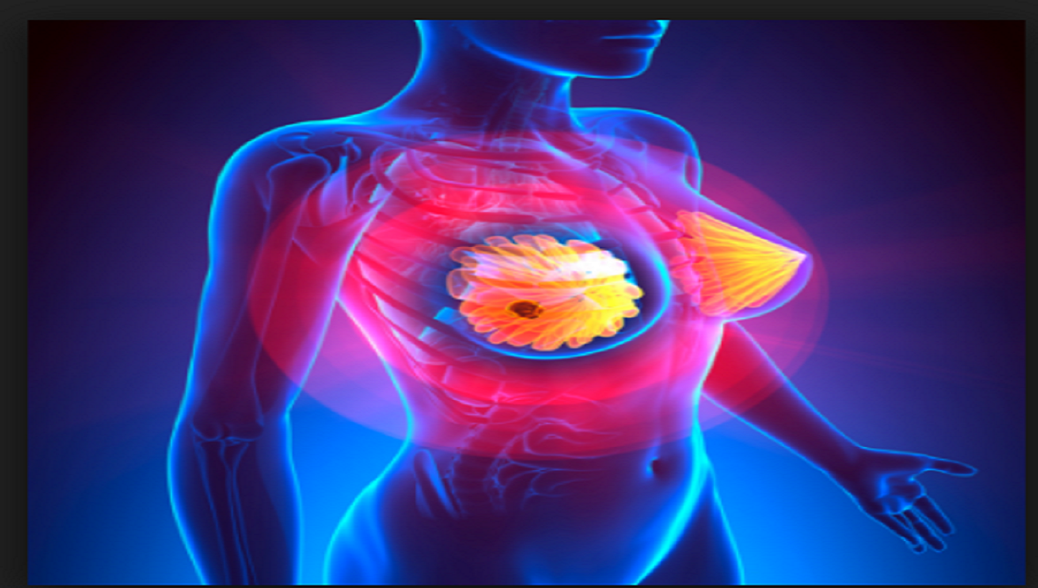 Ανατρεπτική έρευνα για τα καρκινικά κύτταρα του μαστού
