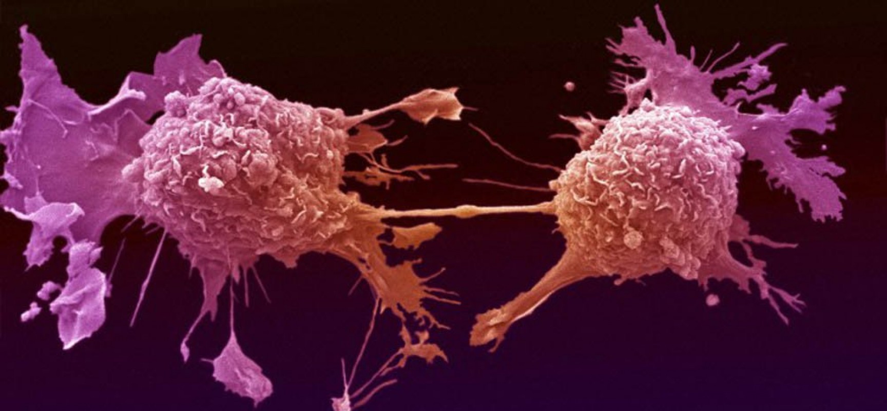 Ποια τροφή διεγείρει τα καρκινικά κύτταρα;